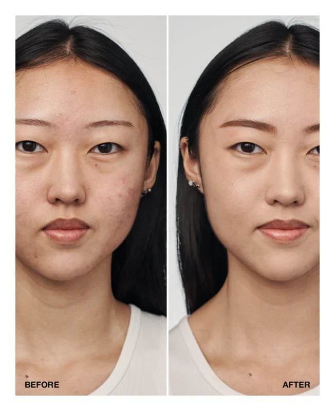 Base Even Better Clinical  Spf 20 Ivory 30Ml | Clinique - Image 2