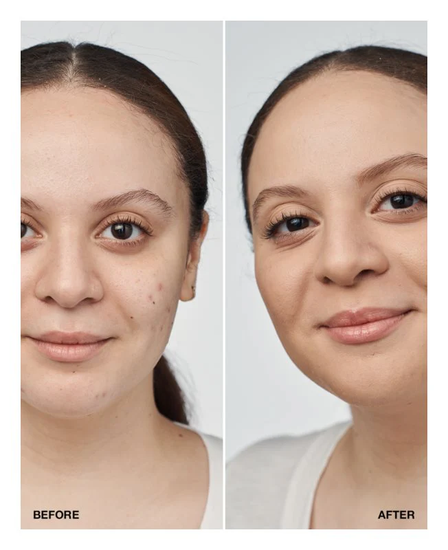 Base Even Better Clinical  Spf 20 Neutral 30Ml | Clinique - Image 2