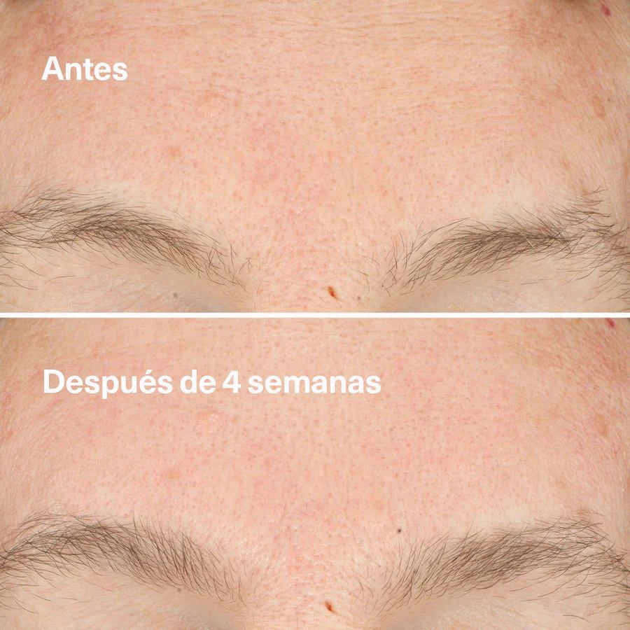 Locion Clarificante Do-Over Peel 30Ml | Clinique - Image 4