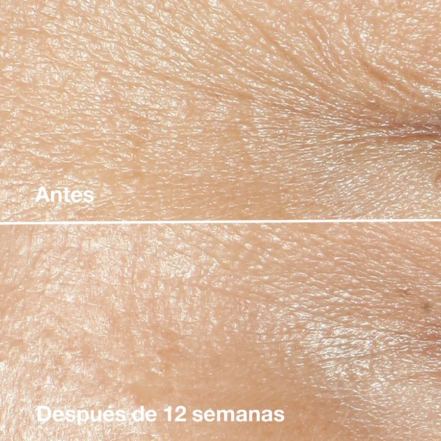 Crema Antiarrugas Clinique Smart Clinical Repair 50Ml | Clinique - Image 4