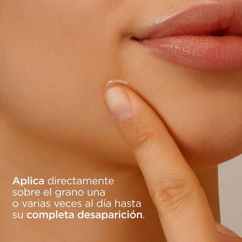 Isdin Acniben On The Spot 15Ml - Gel Corrector De Granos Faciales Localizados Para Piel El Mixta A Grasa - Image 6