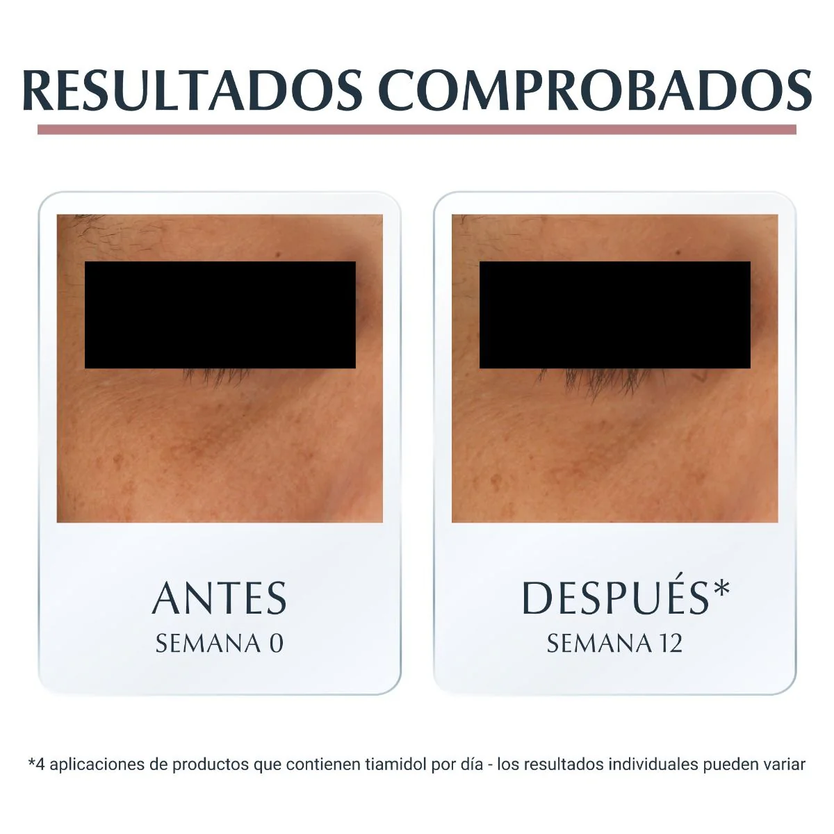 Pack Eucerin Rutina Despigmentante - Image 12