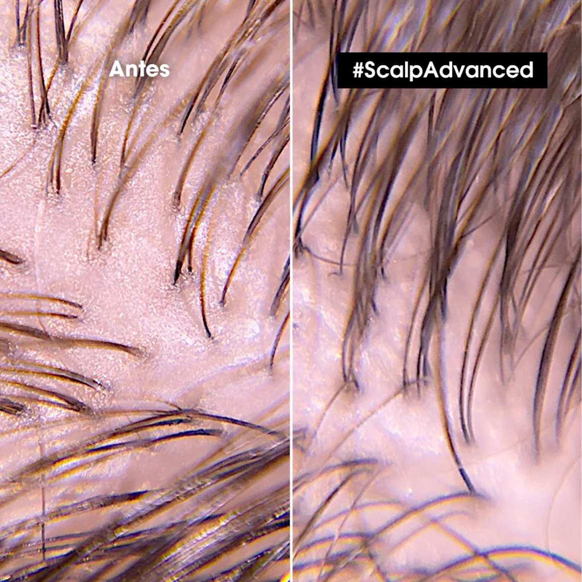 Shampoo En Gel Que Purifica El Cuero Cabelludo y La Fibra De Residuos, Sudor y Grasa Para Una Sensación Más Fresca Y Limpia Scalp Advanced Anti-Oiliness 500 Ml Loreal Professionnel - Image 3